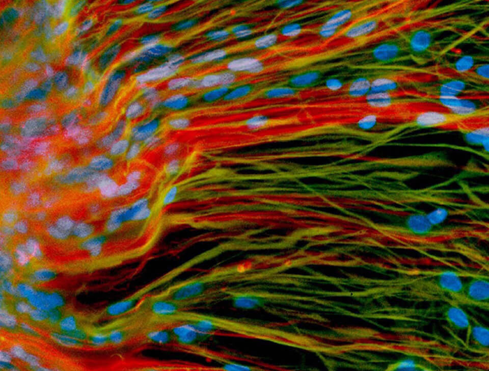 Colorful visualization of neural stem cells